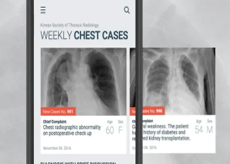Weekly Chest Cases